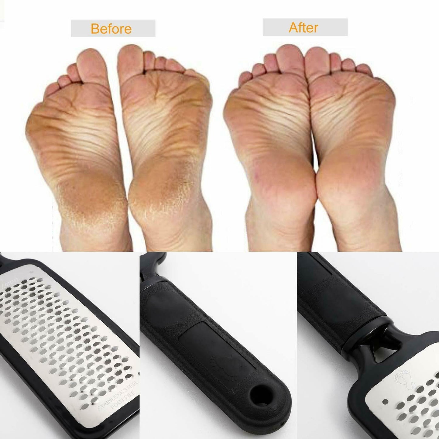 Foot Care Scraper