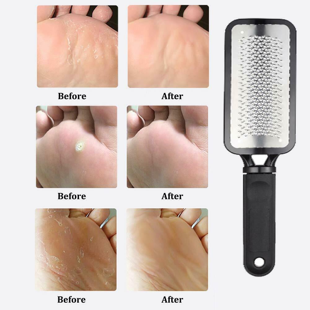 Foot Care Scraper